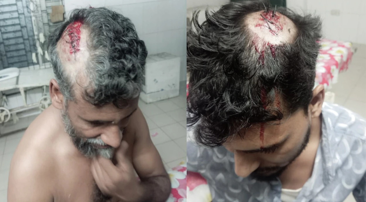 সলঙ্গায় জমির গাছ কাটা নিয়ে সংঘর্ষে আহত ৭ জন